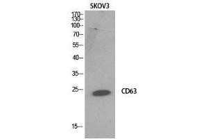Western Blot (WB) analysis of SKOV3 cells using CD63 Polyclonal Antibody. (CD63 antibody  (Internal Region))