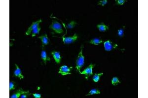 Immunofluorescent analysis of U251 cells using ABIN7175089 at dilution of 1:100 and Alexa Fluor 488-congugated AffiniPure Goat Anti-Rabbit IgG(H+L)