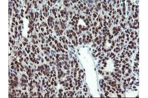Image no. 1 for anti-Mannose Phosphate Isomerase (MPI) antibody (ABIN1499543) (MPI antibody)