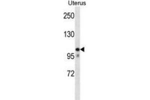 Western blot analysis in human normal Uterus cell line lysates (35ug/lane) using MOV10 Antibody (N-term). (MOV10 antibody  (N-Term))