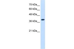 Western Blotting (WB) image for anti-Isocitrate Dehydrogenase 3 (NAD+) alpha (IDH3A) antibody (ABIN2462553) (IDH3A antibody)