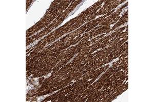 Immunohistochemical staining of human smooth muscle with FGFR4 polyclonal antibody  shows strong cytoplasmic positivity in smooth muscle cells at 1:50-1:200 dilution. (FGFR4 antibody)