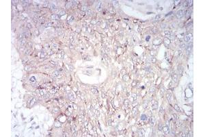 Immunohistochemistry (IHC) image for anti-Zinc Finger Protein GLI1 (GLI1) (AA 284-449) antibody (ABIN5542320)