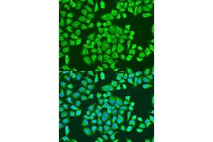 Immunofluorescence analysis of U2OS cells using IGF2BP3 antibody. (IGF2BP3 antibody  (AA 300-579))