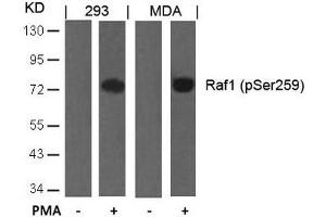 Western blot analysis of extracts from 293 and MDA cells untreated or treated with PMA using Raf1(Phospho-Ser259) Antibody. (RAF1 antibody  (pSer259))