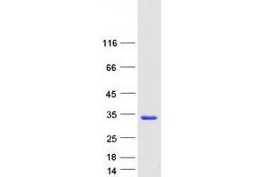 Validation with Western Blot (IL-37 Protein (Transcript Variant 1) (Myc-DYKDDDDK Tag))