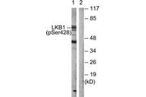 Western blot analysis of extracts from HeLa cells treated with PMA 125ng/ml 30', using LKB1 (Phospho-Ser428) Antibody. (LKB1 antibody  (pSer428))