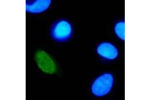 Immunofluorescence (IF) image for anti-Human Papilloma Virus Type 11 (HPV-11) (AA 202-284) antibody (ABIN781775) (Human Papilloma Virus Type 11 (HPV-11) (AA 202-284) antibody)
