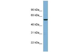 WB Suggested Anti-C2orf29 Antibody Titration: 0. (CNOT11 antibody  (Middle Region))