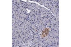 Immunohistochemical staining of human pancreas with KCND1 polyclonal antibody  shows moderate cytoplasmic positivity in Islet cells.