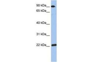 Image no. 1 for anti-Transmembrane Emp24-Like Trafficking Protein 10 (TMED10) (AA 143-192) antibody (ABIN6744308) (TMED10 antibody  (AA 143-192))