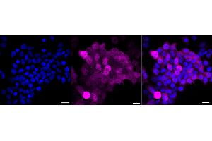 Immunocytochemical staining of HeLa cells with Glutamate-ammonia ligase antibody (ABIN7798741), 1:1,000). (Recombinant GLUL antibody)