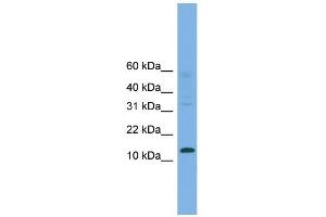 WB Suggested Anti-CRABP2  Antibody Titration: 0. (CRABP2 antibody  (Middle Region))