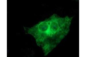 Image no. 3 for anti-Tubulin, beta 2B (TUBB2B) antibody (ABIN1501573) (TUBB2B antibody)