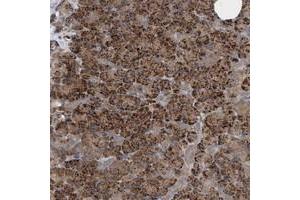 Immunohistochemical staining of human pancreas with CAMSAP1 polyclonal antibody  shows strong cytoplasmic positivity in exocrine glandular cells at 1:200-1:500 dilution. (CAMSAP1 antibody)