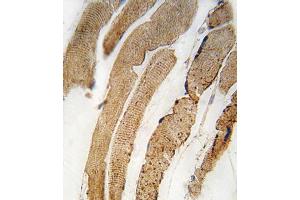 Formalin-fixed and paraffin-embedded human skeletal muscle tissue reacted with PDK4 antibody (Center D98) f , which was peroxidase-conjugated to the secondary antibody, followed by DAB staining. (PDK4 antibody  (AA 83-111))