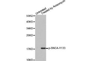 Western blot analysis of extracts from C2C12 cells, using Phospho-SNCA-Y133 antibody. (SNCA antibody  (pTyr133))