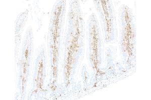 Immunohistochemistry (IHC) image for anti-CD48 (CD48) (AA 23-216) antibody (ABIN7795672)