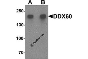 Western Blotting (WB) image for anti-DEAD (Asp-Glu-Ala-Asp) Box Polypeptide 60 (DDX60) antibody (ABIN1587945)