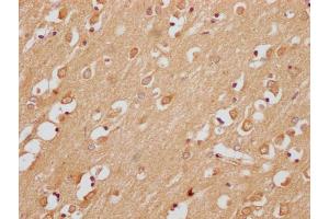 IHC image of ABIN7174940 diluted at 1:200 and staining in paraffin-embedded human brain tissue performed on a Leica BondTM system. (Uncharacterized Protein SMIM29 (SMIM29) (AA 42-102) antibody)