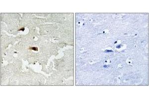 Immunohistochemistry analysis of paraffin-embedded human brain tissue, using NF-kappaB p65 (Ab-536) Antibody. (NF-kB p65 antibody  (AA 502-551))