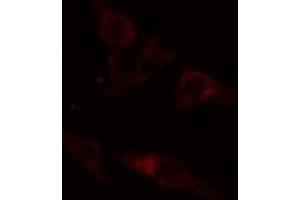 ABIN6274414 staining A549 cells by IF/ICC. (ADCK1 antibody  (Internal Region))