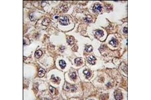 Image no. 1 for anti-Insulin Receptor-Related Receptor (INSRR) (N-Term) antibody (ABIN359888) (INSRR antibody  (N-Term))
