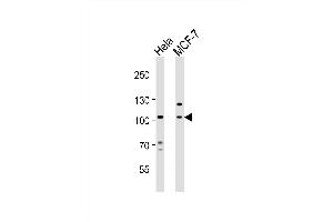 Western blot analysis of lysates from Hela, MCF-7 cell line (from left to right), using EPHA4 Antibody (Center) (ABIN6243787 and ABIN6577677). (EPH Receptor A4 antibody  (AA 417-451))