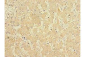 Immunohistochemistry of paraffin-embedded human liver tissue using ABIN7153109 at dilution of 1:100 (FTCD antibody  (AA 412-541))