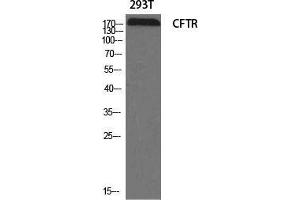 Western Blot (WB) analysis of specific cells using CFTR Polyclonal Antibody.