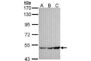 WB Image Sample (30 ug of whole cell lysate) A:A431 , B: H1299 C: Hela 7. (KCNJ3 antibody  (Center))