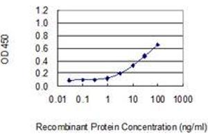 Detection limit for recombinant GST tagged DKC1 is 0. (DKC1 antibody  (AA 1-514))