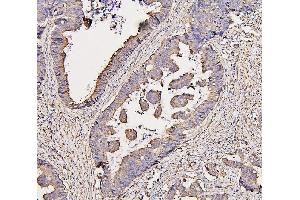 IHC analysis of COX IV using anti-COX IV antibody (ABIN7602090). (COX IV antibody  (AA 59-169))
