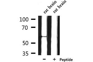 Western blot analysis of extracts from rat brain, using CHRM5 Antibody. (CHRM5 antibody  (C-Term))