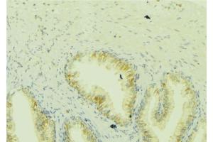 ABIN6273049 at 1/100 staining Mouse colon tissue by IHC-P. (ICT1 antibody)