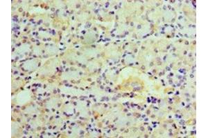 Immunohistochemistry of paraffin-embedded human pancreatic tissue using ABIN7151949 at dilution of 1:100 (EPHX1 antibody  (AA 1-455))