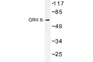 Image no. 1 for anti-G Protein-Coupled Receptor Kinase 6 (GRK6) antibody (ABIN272191) (GRK6 antibody)