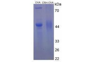 Image no. 1 for Corticotropin Releasing Hormone (CRH) peptide (Ovalbumin) (ABIN5666142)