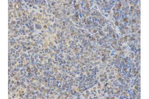 Immunohistochemistry (IHC) image for anti-Neural Wiskott-Aldrich syndrome protein (WASL) antibody (ABIN1875345) (Neural Wiskott-Aldrich syndrome protein (WASL) antibody)