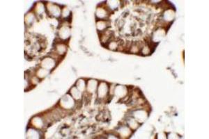 Immunohistochemistry of ZFX in human small intestine tissue with ZFX antibody at 5 ug/mL. (ZFX antibody  (C-Term))