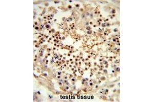 Formalin-fixed and paraffin-embedded human testis tissue reacted with RS18 Antibody (Center), which was peroxidase-conjugated to the secondary antibody, followed by DAB staining. (UNC119 antibody  (Middle Region))