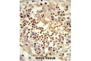 Formalin-fixed and paraffin-embedded human testis tissue reacted with RS18 Antibody (Center), which was peroxidase-conjugated to the secondary antibody, followed by DAB staining. (UNC119 antibody  (Middle Region))