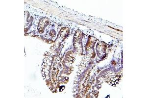 IHC analysis of EIF4A using anti-EIF4A antibody (ABIN7601309). (EIF4A1 antibody  (AA 32-406))