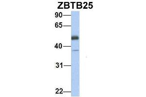 Host:  Rabbit  Target Name:  ZBTB25  Sample Type:  Human Fetal Heart  Antibody Dilution:  1. (ZBTB25 antibody  (Middle Region))