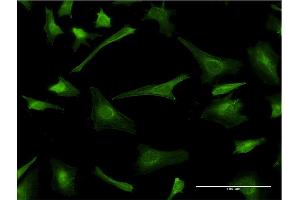 Immunofluorescence of monoclonal antibody to PLP1 on HeLa cell. (PLP1 antibody  (AA 177-232))