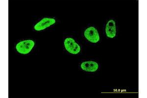 Immunofluorescence of monoclonal antibody to CRKRS on HeLa cell.