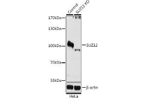 Western blot analysis of extracts from normal (control) and SUZ12 knockout (KO) HeLa cells, using SUZ12 antibody (ABIN6127300, ABIN6148752, ABIN6148754 and ABIN7101816) at 1:1000 dilution. (SUZ12 antibody  (AA 470-739))