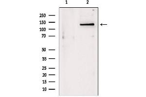 Western blot analysis of extracts from Mouse myeloma, using DHX9 antibody. (DHX9 antibody  (C-Term))