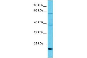 Host: Rabbit Target Name: TMBIM1 Sample Type: Jurkat Whole Cell lysates Antibody Dilution: 1. (TMBIM1 antibody  (N-Term))