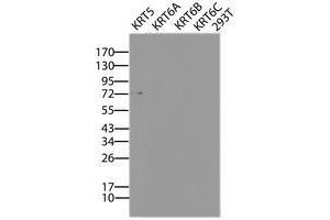 Image no. 2 for anti-Keratin 5 (KRT5) (AA 1-273) antibody (ABIN1490697) (Cytokeratin 5 antibody  (AA 1-273))